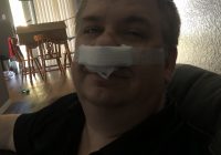 After Surgery for a deviated septum